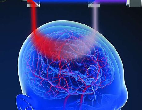 Medical use: to measure cerebral blood flow.